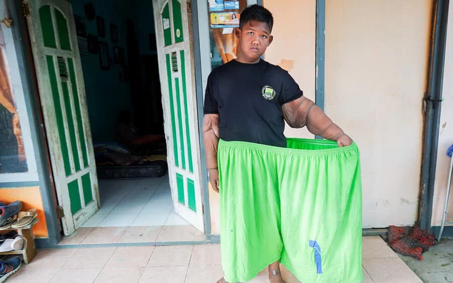 a világ legkövérebb gyermeke, aki 9 évesen közel 200 kilót nyomott (FOTÓK)