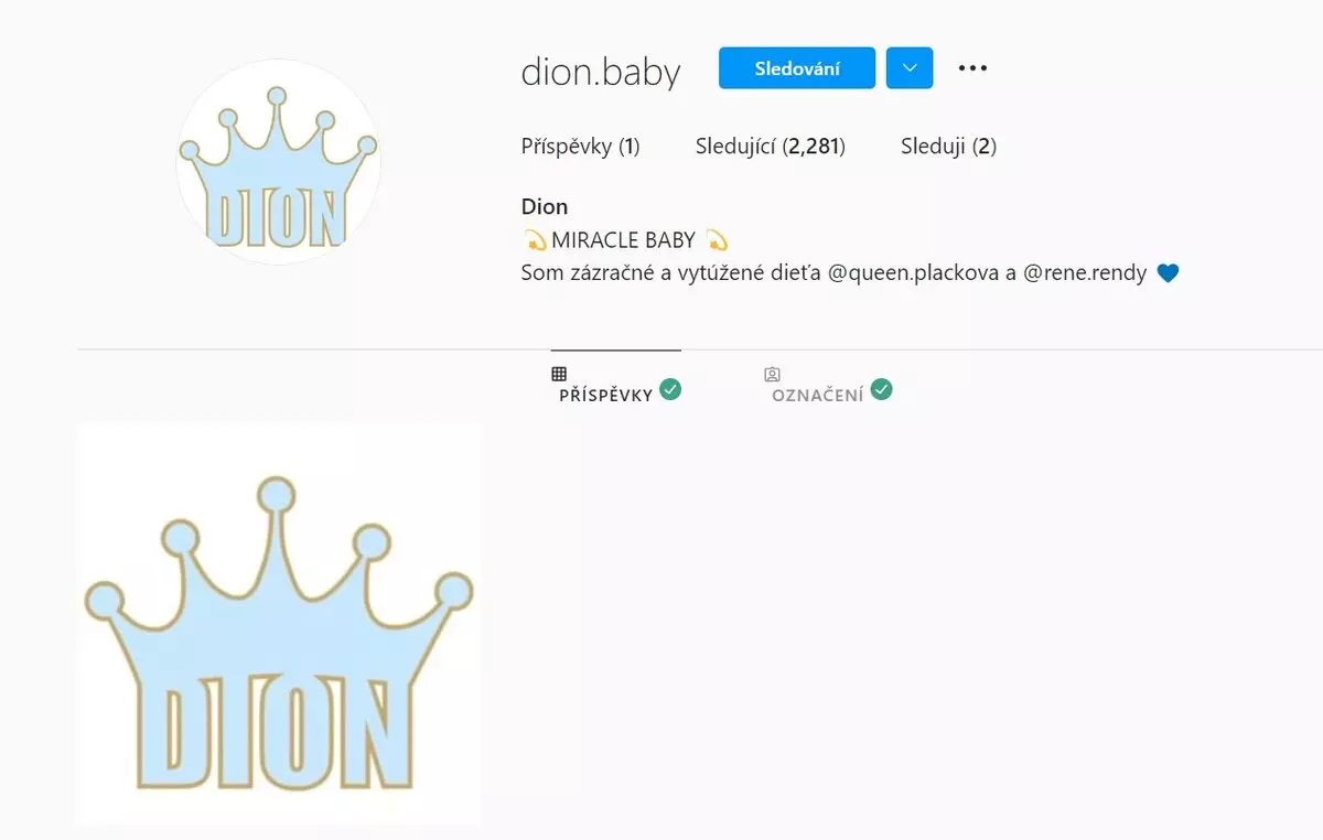  A még pocaklakó Dionnak már el is készítették a saját Instagram-fiókját, ahol majd valószínűleg eleinte a szülők által, a kisfiú is influenszerré válhat. Egyelőre csak annyit osztottak meg róla, hogy „csoda bébi”, de már 2 ezernél több követője van. 