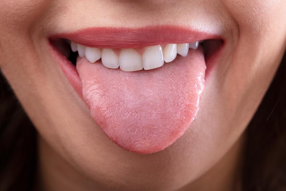 Ha a nyelv alja kékes színű, és kiálló, kitágult erek vannak rajta, ideje felkeresni egy kardiológust.