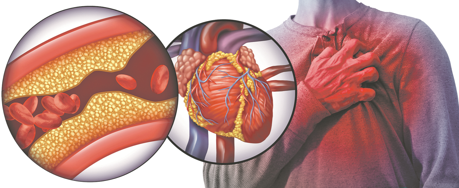 a magas vérnyomás a szív- és érrendszer betegsége