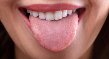 Ha a nyelv alja kékes színű, és kiálló, kitágult erek vannak rajta, ideje felkeresni egy kardiológust.