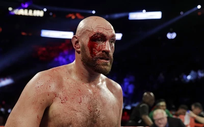 Tyson Fury