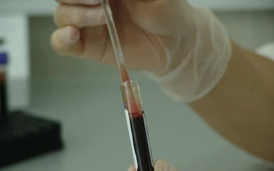 hiv-teszt aids vér