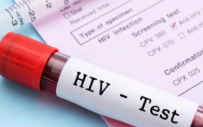 Ausztrália felszámolta az AIDS-járványt