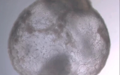 embrió szintetikus izrael jacob hanna
