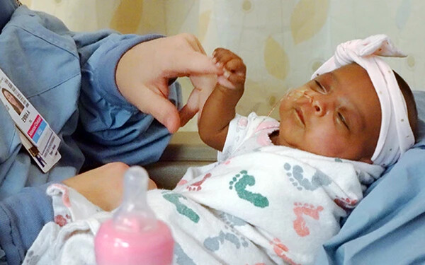 a világ legkisebb súlyú újszülöttje