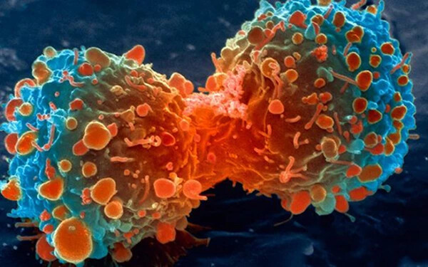 Filmre vették a rákos sejtek terjedését – VIDEO