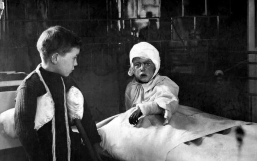 1915 - Az első világháborúban megsérült gyerekek a kórházban