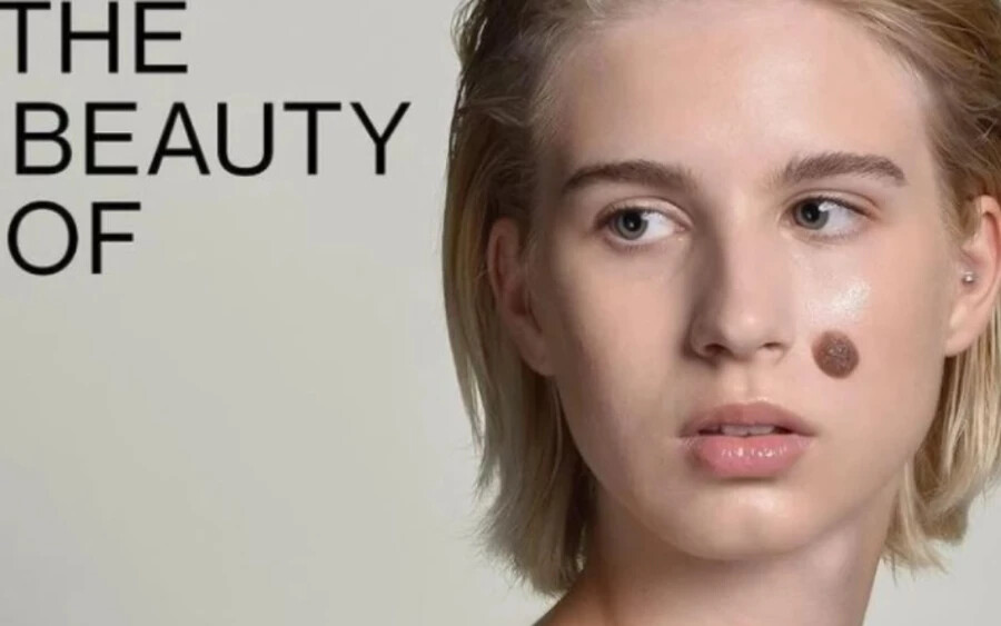 A 17 éves Emma még hosszú hajjal a Noili kozmetikai cég kampányban szerepel.