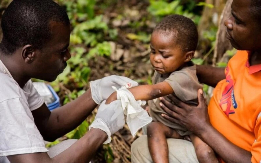 Halálos lehet a fertőzés? Amr Bayoumy virológus szerint: „A halálozási arány három-hat százalék, a kisgyermekeknél magasabb. Ez a helyzet a kongói törzs esetében; a nyugat-afrikai törzs halálozási arányát körülbelül egy százalékra becsülik."