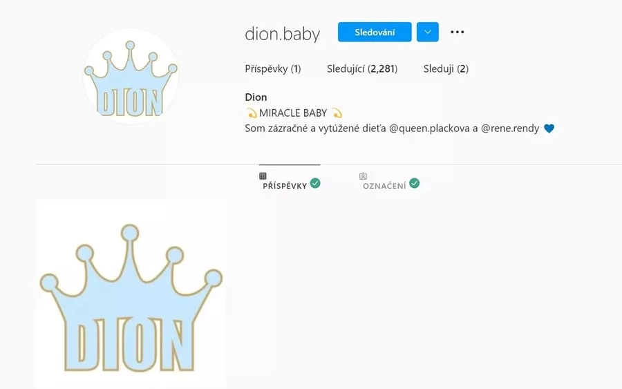  A még pocaklakó Dionnak már el is készítették a saját Instagram-fiókját, ahol majd valószínűleg eleinte a szülők által, a kisfiú is influenszerré válhat. Egyelőre csak annyit osztottak meg róla, hogy „csoda bébi”, de már 2 ezernél több követője van. 